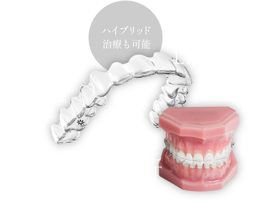 ハイブリッド治療も可能