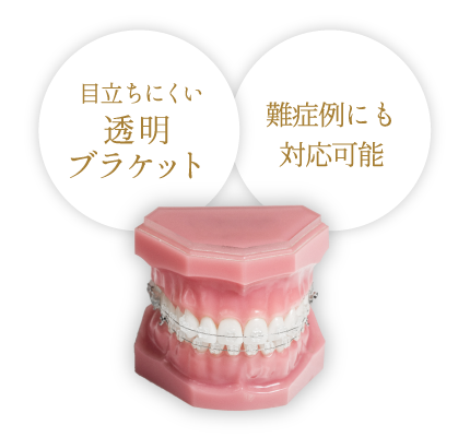 目立ちにくい透明ブラケット／難症例にも対応可能
